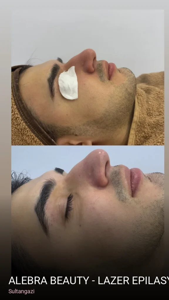Sultangazi Alebra Beauty - Lazer Epilasyon, Cilt Bakımı, Kirpik Lifting, Kalıcı Makyaj, Manikür Pedikür — Manikür, Pedikür, C