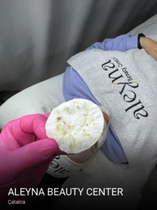 Çatalca Aleyna Beauty Center — Ağda