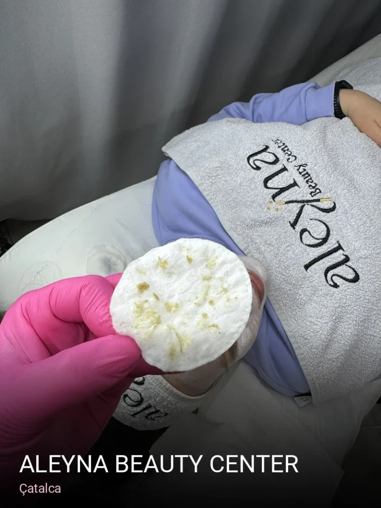 Çatalca Aleyna Beauty Center — Manikür, Pedikür, Cilt Bakımı