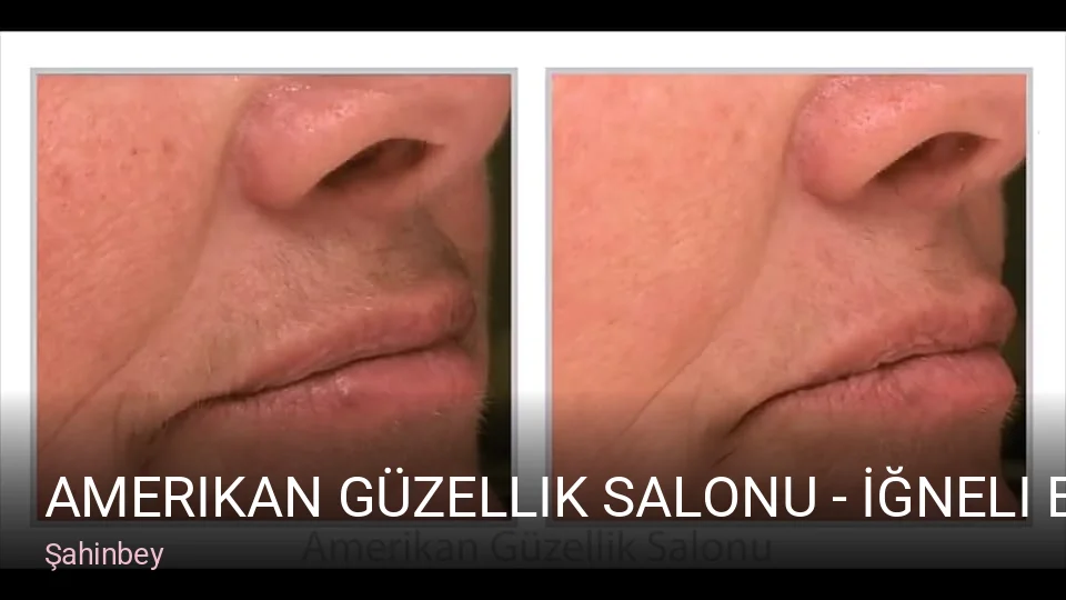 Şahinbey Amerikan Güzellik Salonu - İğneli Epilasyon — Manikür, Pedikür, Cilt Bakımı
