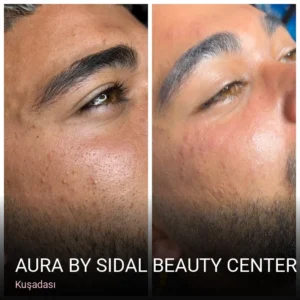 Kuşadası Aura By Sidal Beauty Center — Ağda