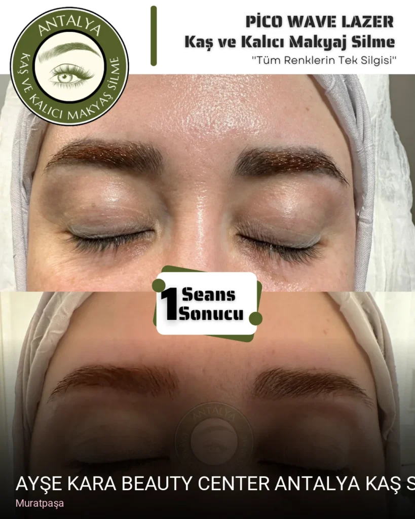 Muratpaşa Ayşe KARA Beauty Center Antalya Kaş Silme Dövme Silme Uzmanı — Manikür, Pedikür, Cilt Bakımı