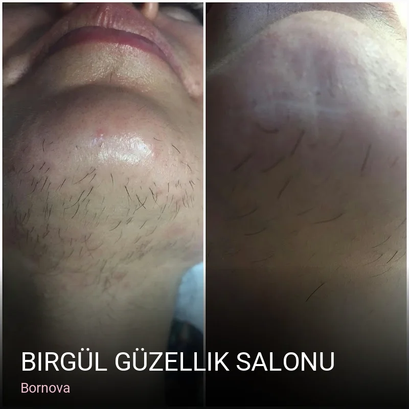 Bornova Birgül Güzellik Salonu — Manikür, Pedikür, Cilt Bakımı