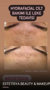 Ödemiş ESTETİSYA BEAUTY & MAKEUP STUDIO — Cilt Bakımı