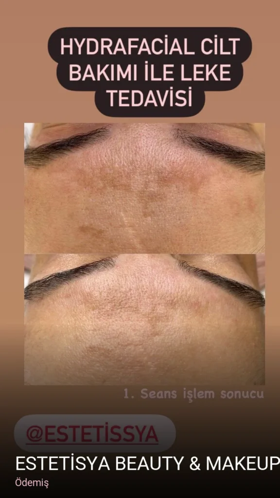Ödemiş ESTETİSYA BEAUTY & MAKEUP STUDIO — Manikür, Pedikür, Cilt Bakımı