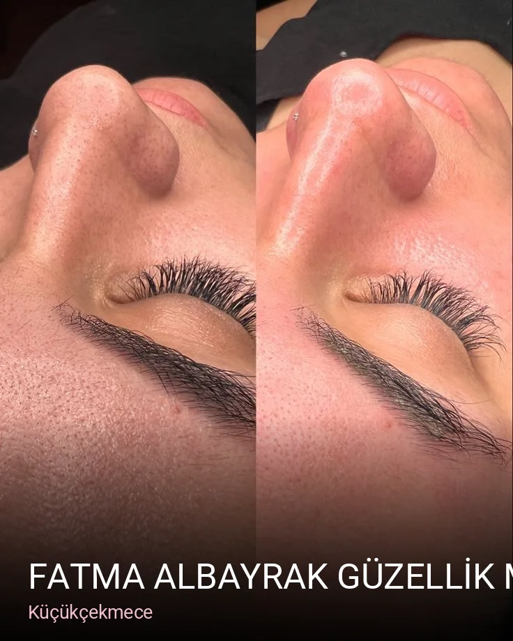 Küçükçekmece FATMA ALBAYRAK GÜZELLİK MERKEZİ — Manikür, Pedikür, Cilt Bakımı