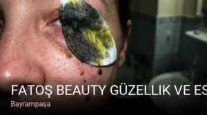 Bayrampaşa Fatoş Beauty Güzellik ve Estetik — Cilt Bakımı