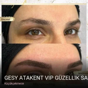 Küçükçekmece Gesy Atakent VIP Güzellik Salonu — Cilt Bakımı