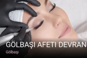 Gölbaşı Gölbaşı Afeti Devran Güzellik Salonu — Ağda