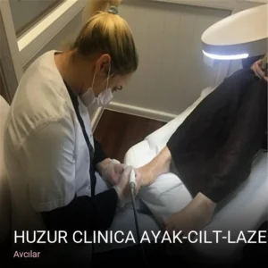 Avcılar Huzur Clinica Ayak-Cilt-Lazer Epilasyon Bakım Salonu — Lazer Epilasyon