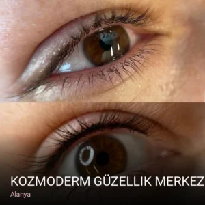 Alanya Kozmoderm Güzellik Merkezi — Ağda