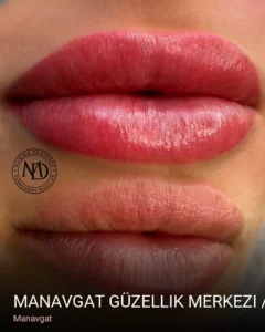 Manavgat Manavgat Güzellik Merkezi / D'lüx Beauty — Cilt Bakımı