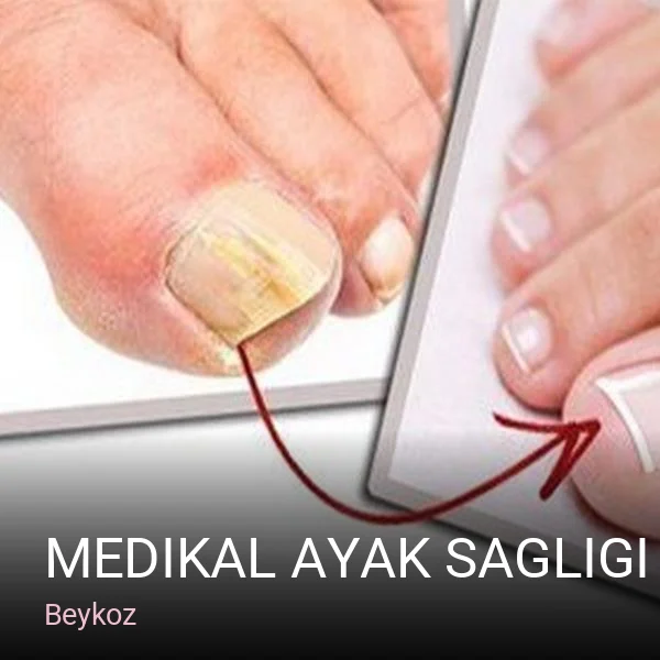 Beykoz Medikal ayak sagligi Svetlana manikür pedikür bay bayan — Manikür, Pedikür, Protez Tırnak