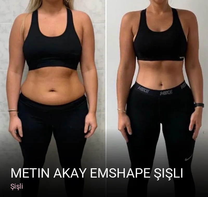 Şişli Metin Akay Emshape Şişli — Manikür, Pedikür, Cilt Bakımı
