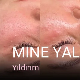 Yıldırım Mine Yaldız Beauty Studio - Güzellik Salonu — Manikür, Pedikür, Cilt Bakımı