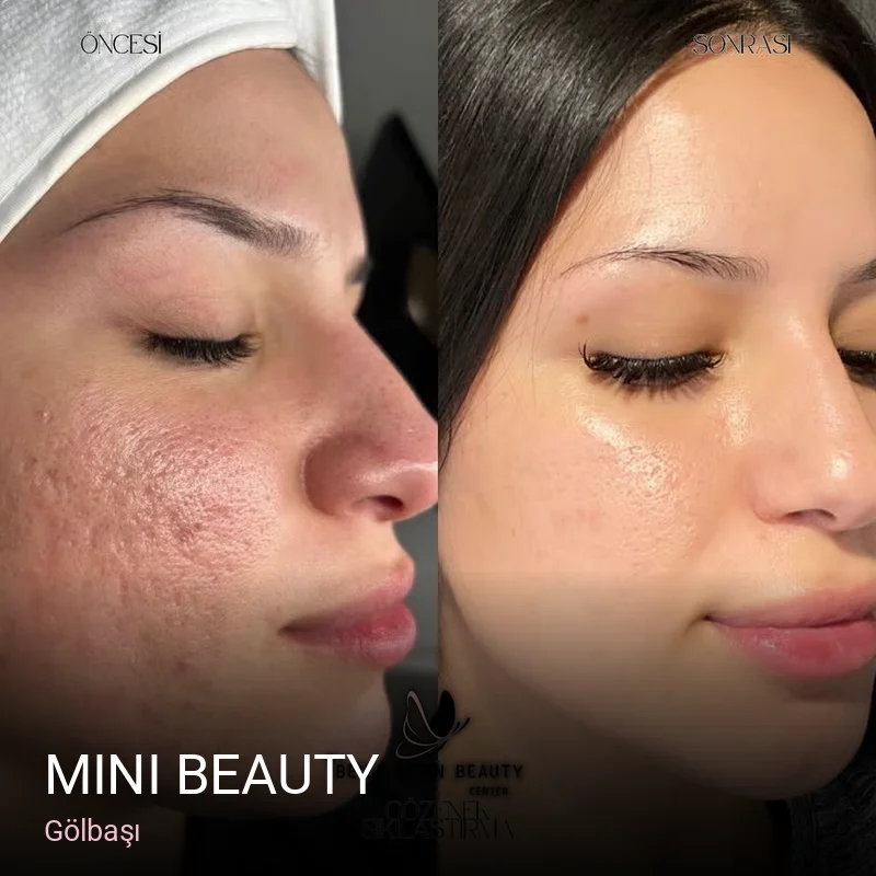 Gölbaşı Mini Beauty — Manikür, Pedikür, Cilt Bakımı