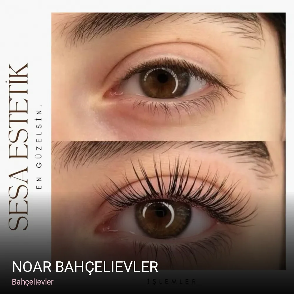 Bahçelievler Noar Bahçelievler — Saç Bakımı, Keratin