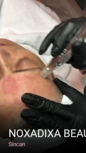 Sincan Noxadixa Beauty Center Sincan Güzellik Salonu — Cilt Bakımı