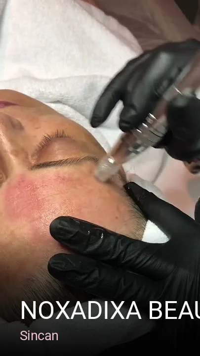 Sincan Noxadixa Beauty Center Sincan Güzellik Salonu — Manikür, Pedikür, Cilt Bakımı