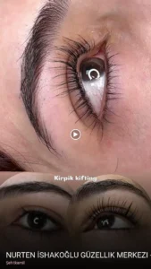 Şehitkamil Nurten İshakoğlu Güzellik Merkezi - Gaziantep Lazer Epilasyon - Kalıcı Makyaj - Cilt Bakımı - Dermapen — Ağda