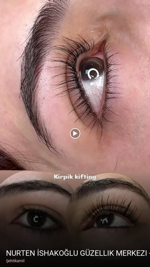 Şehitkamil Nurten İshakoğlu Güzellik Merkezi - Gaziantep Lazer Epilasyon - Kalıcı Makyaj - Cilt Bakımı - Dermapen — Manikür, 