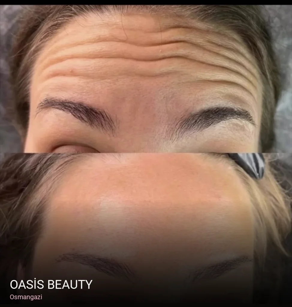 Osmangazi OASİS BEAUTY — Manikür, Pedikür, Cilt Bakımı