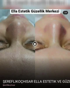 Şereflikoçhisar Şereflikoçhisar Ella Estetik ve Güzellik Merkezi — Kirpik Lifting