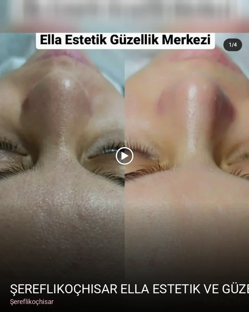 Şereflikoçhisar Şereflikoçhisar Ella Estetik ve Güzellik Merkezi — Manikür, Pedikür, Cilt Bakımı