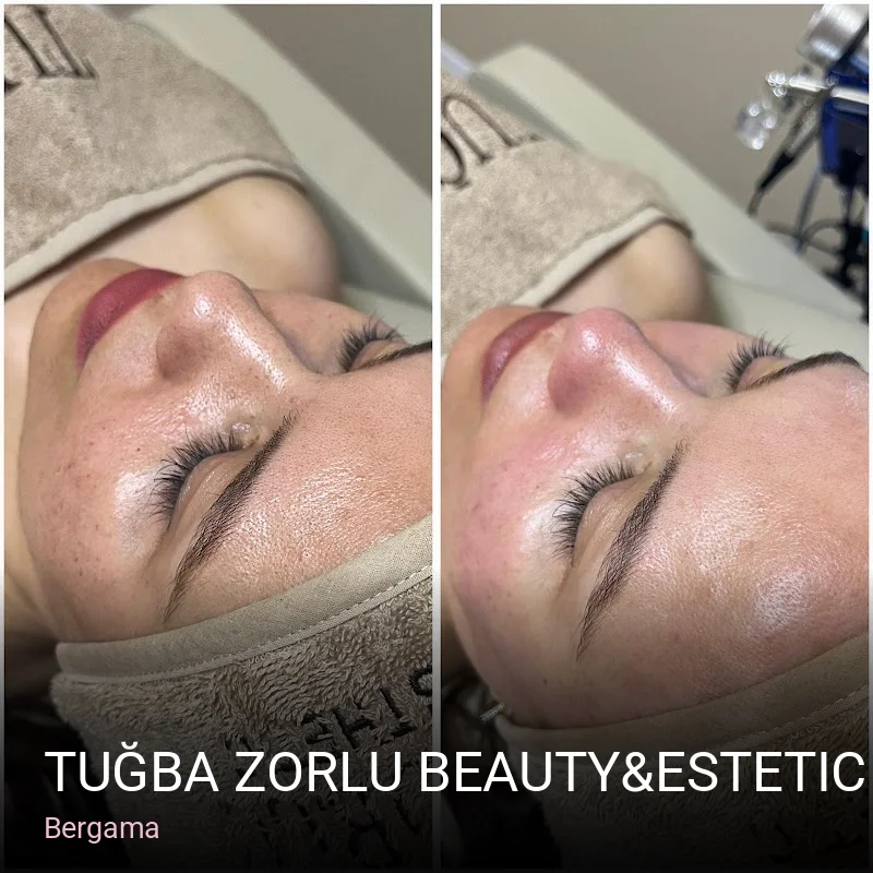 Bergama TUĞBA ZORLU BEAUTY&ESTETIC BERGAMA — Manikür, Pedikür, Cilt Bakımı
