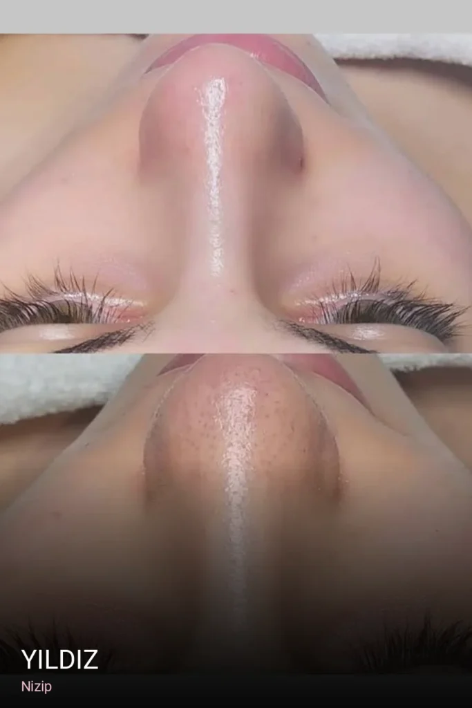 Nizip YILDIZ — Saç Bakımı, Keratin