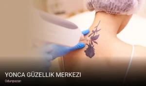 Odunpazarı Yonca Güzellik Merkezi — Lazer Epilasyon